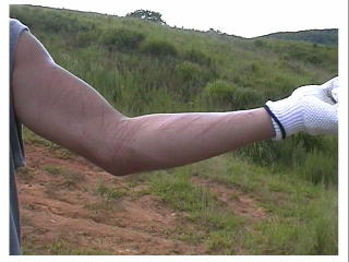 �V�������c�l�b�K�[�����`