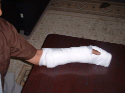 �w��̖D�������Ȃ̂ɁA��Ƙr���M�u�X�Ōł߂�